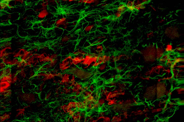 8 S100 and GFAP tangential nucleus