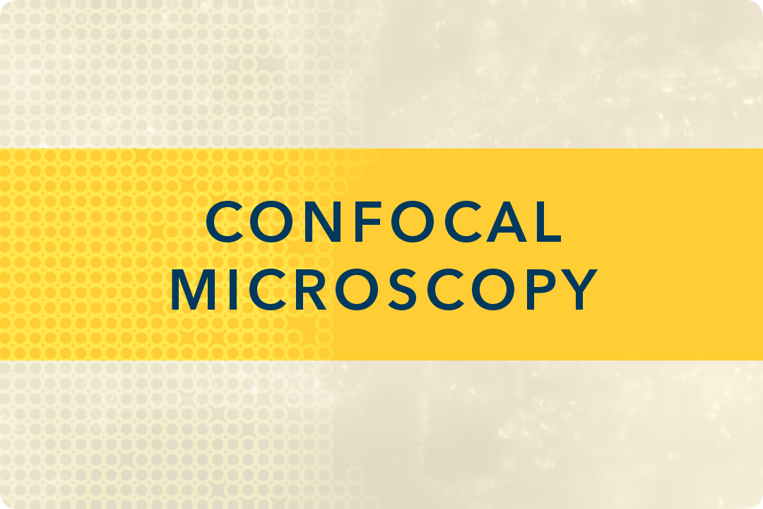 Confocal Microscopy
