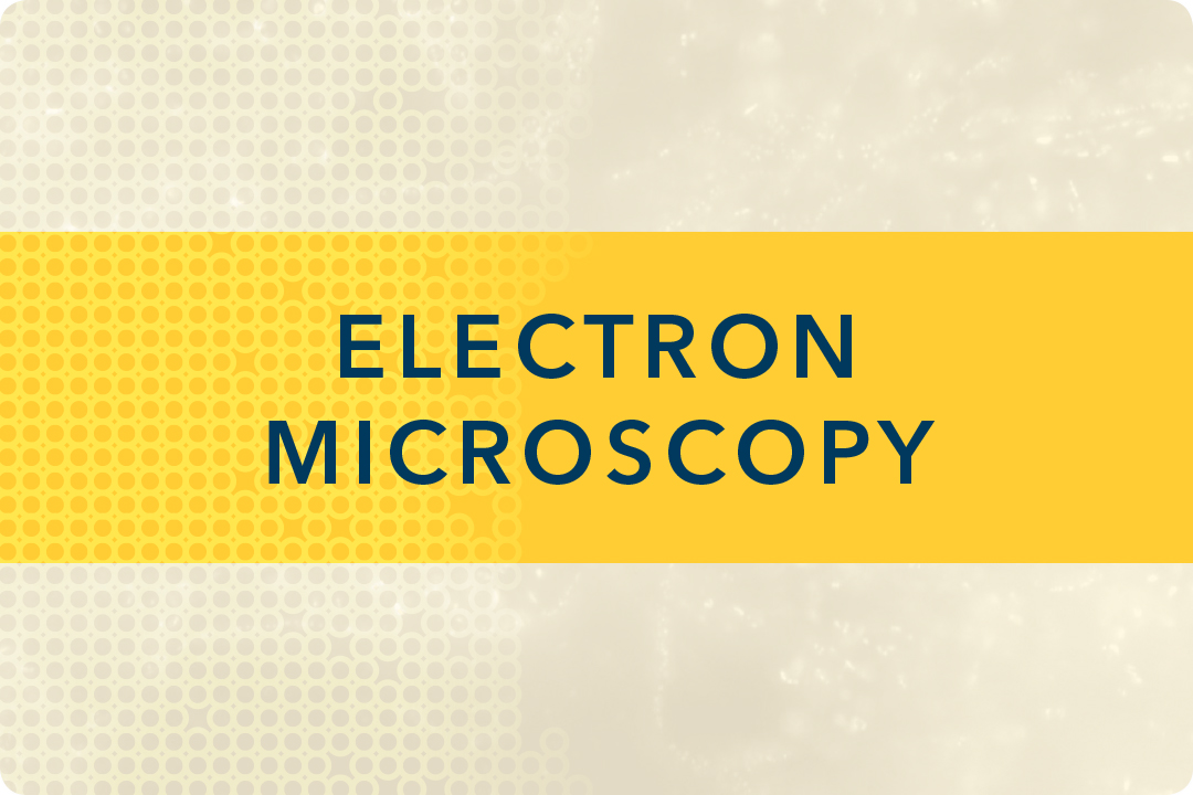 Electron Microscopy