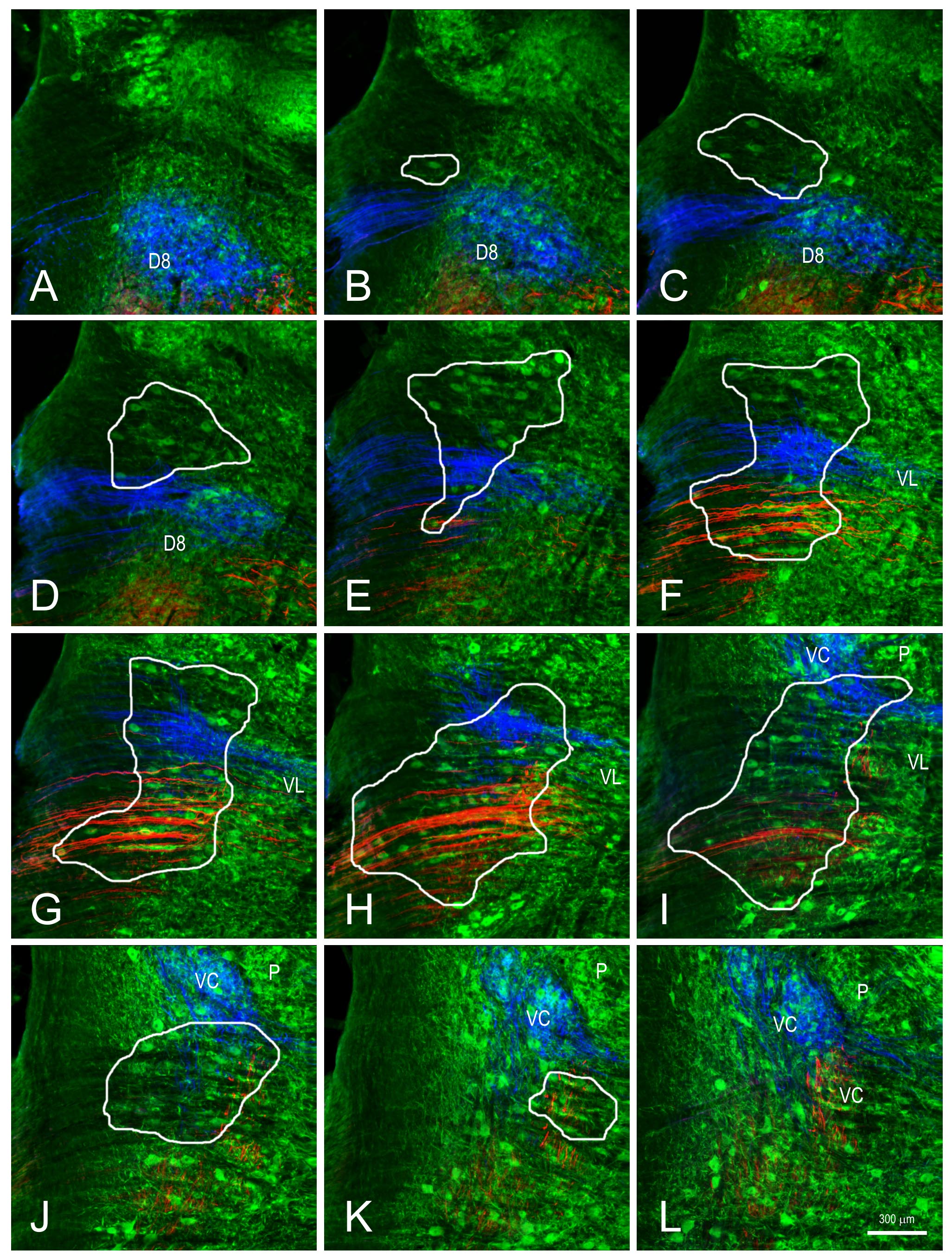 saccular utricular fibers and map