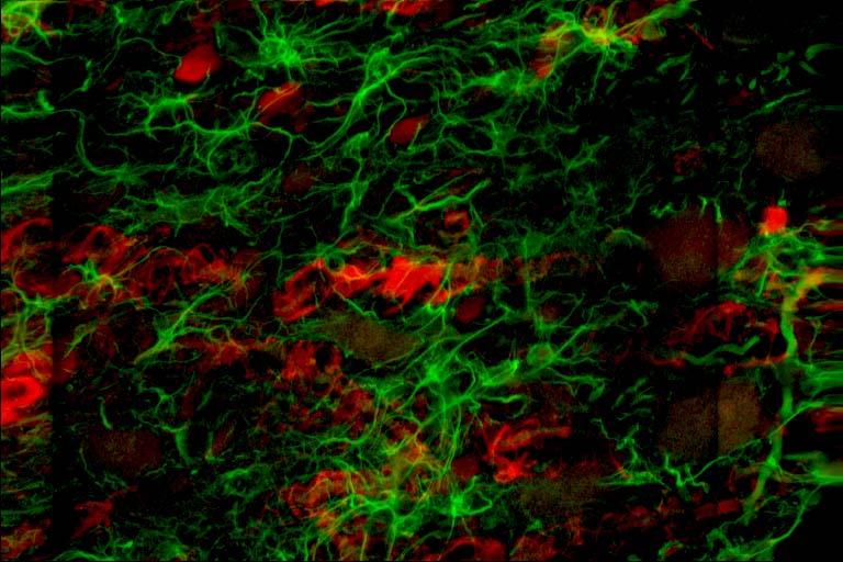 8 S100 and GFAP tangential nucleus