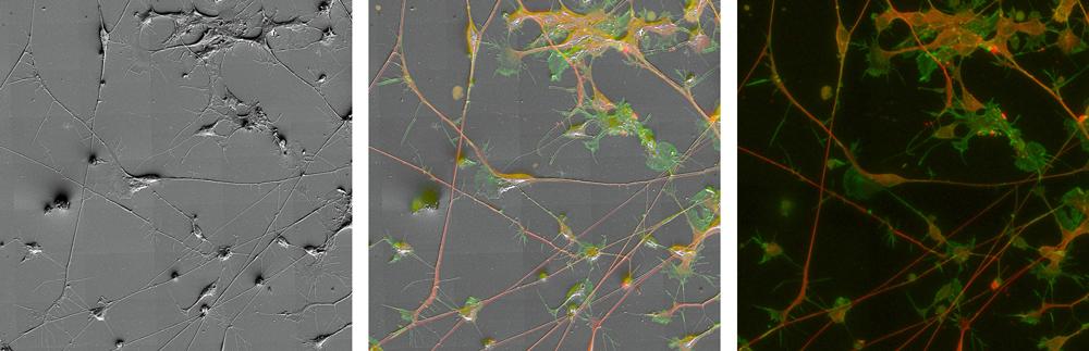 Correlative Light and Electron Microscopy Samples